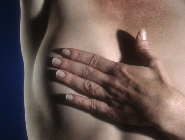 Mutirão para zerar fila de cirurgia de câncer de mama Mutirão para zerar fila de cirurgia de câncer de mama