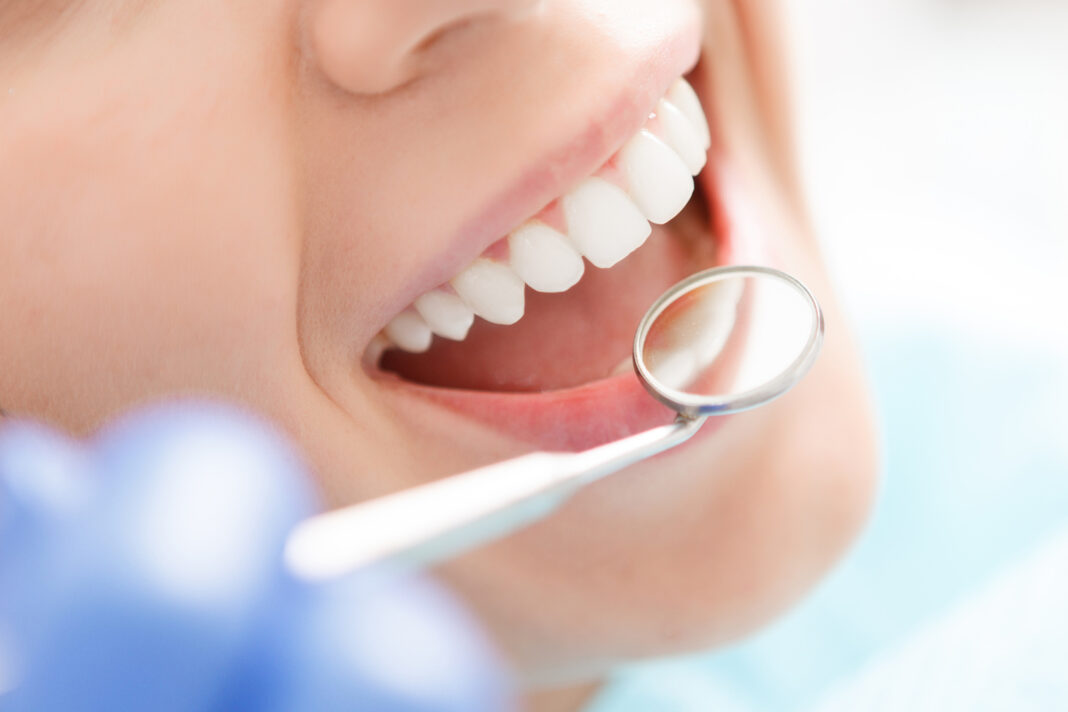 Conheça as 5 doenças bucais mais comuns e como evitá-las Conheça as 5 doenças bucais mais comuns e como evitá-las
