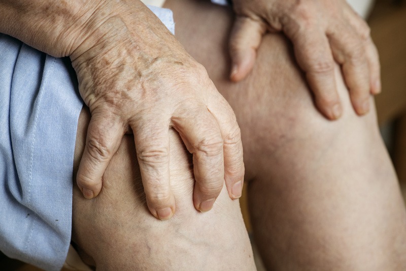 Brasil Sem Varizes: SBACV convoca hospitais e clínicas para integrar o maior mutirão de tratamento de varizes do Brasil Brasil Sem Varizes: SBACV convoca hospitais e clínicas para integrar o maior mutirão de tratamento de varizes do Brasil